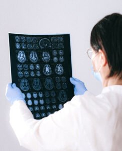 Mental Health – The Brain and Central Nervous System